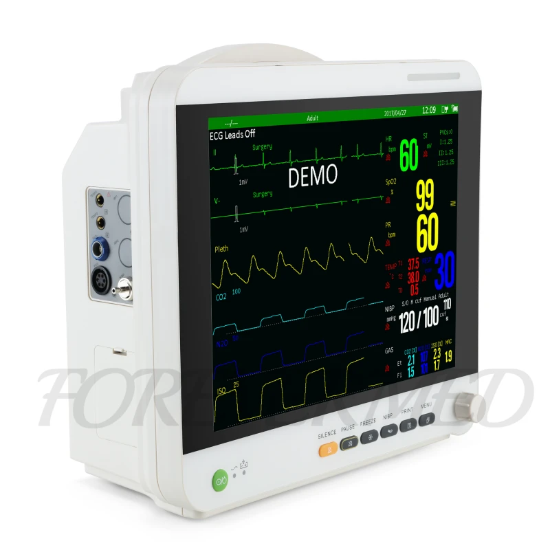 Monitor pacient cu capnografie