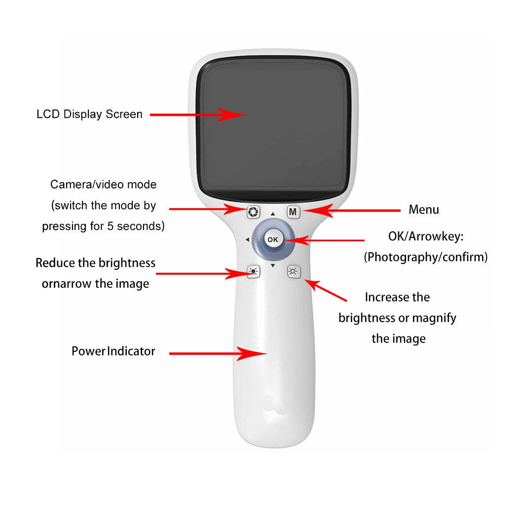 Non Mydriatic Fundus Camera Portable Non Mydriatic Fundus Camera Portable