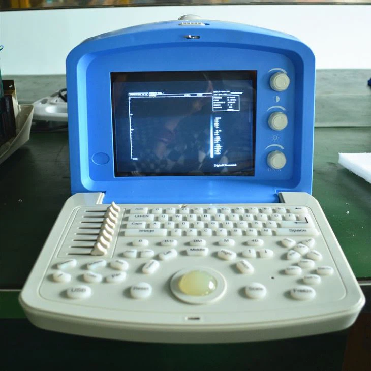 B/W Portable Ultrasound Diagnosis System