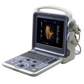 Scaner portabil cu ultrasunete color 4D