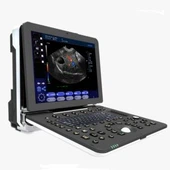 Sistem de diagnosticare cu ultrasunete pentru laptop