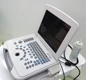 Echipament medical Scaner cu ultrasunete portabil