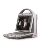 Ecograf oftalmic AB Scan Biometru Pachimetru
