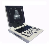 Scaner cu ultrasunete Doppler color 3D cu sondă convexă