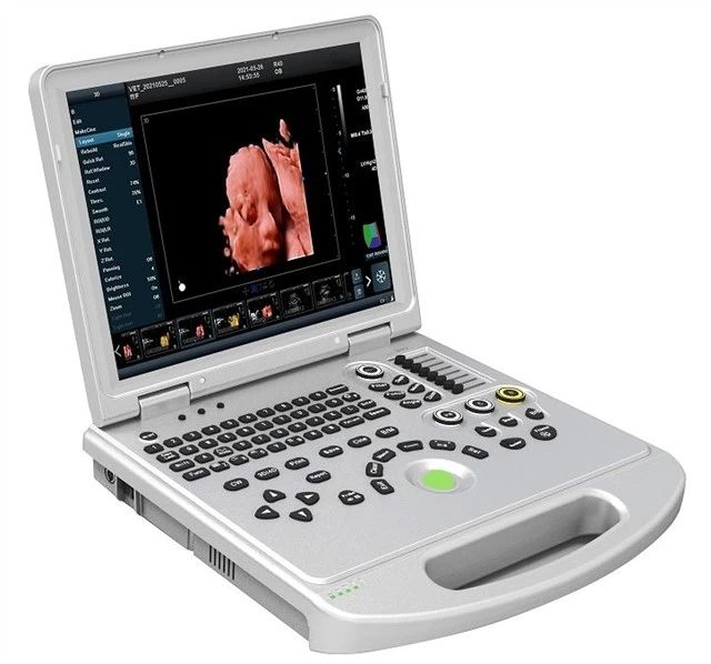 Scaner cu ultrasunete Doppler color 5D