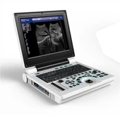 Full Digital Laptop cu ultrasunete