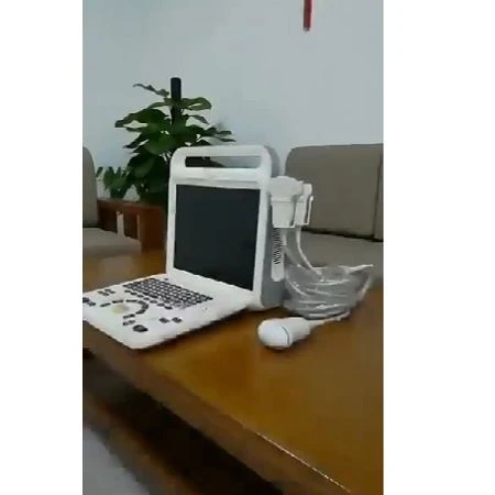 4d Medical Ultrasound Instruments Laptop 4d Medical Ultrasound Instruments Laptop