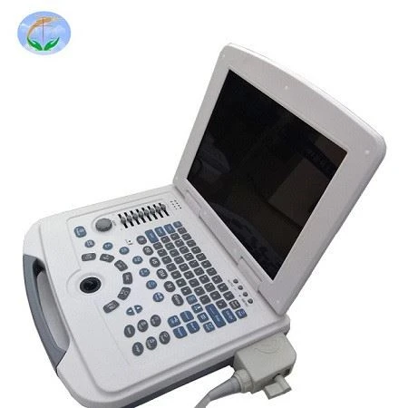 Full-Digital Laptop Ultrasound Scanner