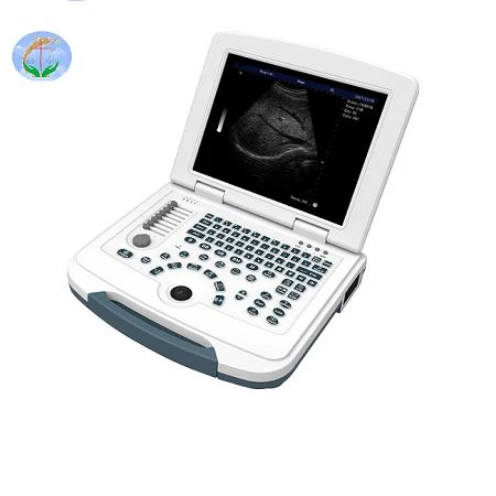 Full-Digital Laptop Ultrasound Scanner
