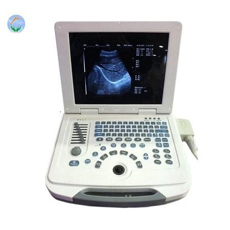 Full-Digital Laptop Ultrasound USG Machine Scanner For Clinic And Hospital Use Full-Digital Laptop Ultrasound USG Machine Scanner For Clinic And Hospital Use