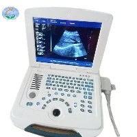 Scaner cu ultrasunete complet digital pentru laptop pentru spital și clinică
