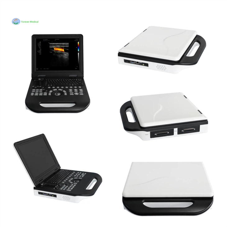 portable color doppler ultrasound